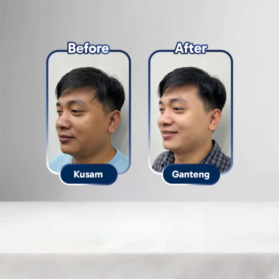 Bromen Acne Fight Expert Facial Wash (Improve Formula) 100ml