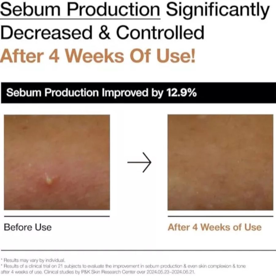 ANUA Rice 70 Glow Milky Toner Wajah 250ml