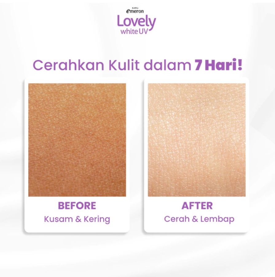 Emeron Lovely White UV Nutrient Bright Body Lotion 500ml