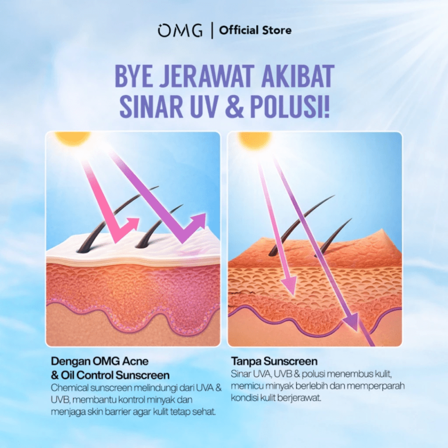 OMG Oh My Glow Acne & Oil Control UV Barrier Sunscreen SPF50 PA++++ 
