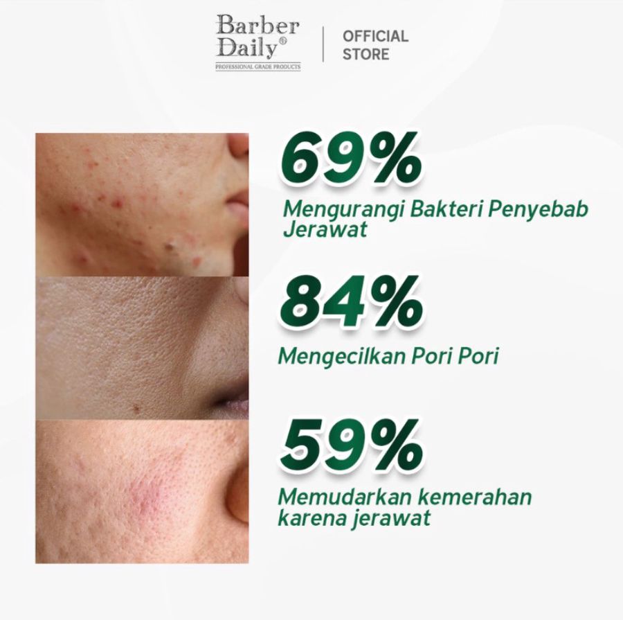 Barber Daily Acne Care & Oil Control Moisturizer 30ml