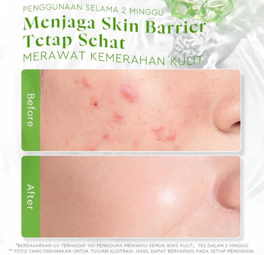 Glad2Glow Centella Ceramide Soothing Toner Wajah 80ml