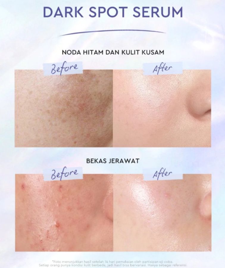 Glad2Glow Yuja Symwhite 377 Dark Spot Serum Wajah 17ml