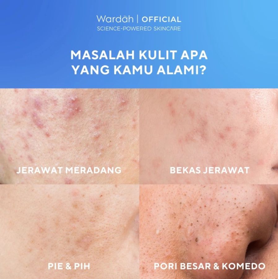 Wardah UV Shield Acne Calming Sunscreen Serum SPF 50 PA++++ 40ml