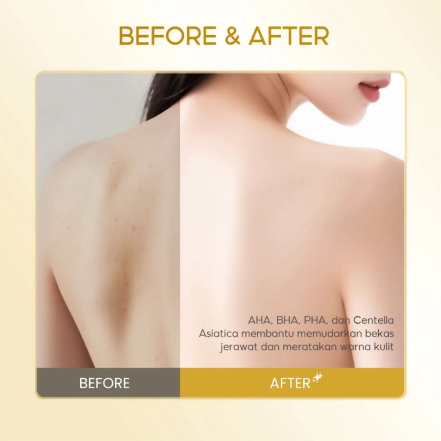 Grace and Glow English Pearl and Freesia Anti Acne Solution Body Wash 400ml