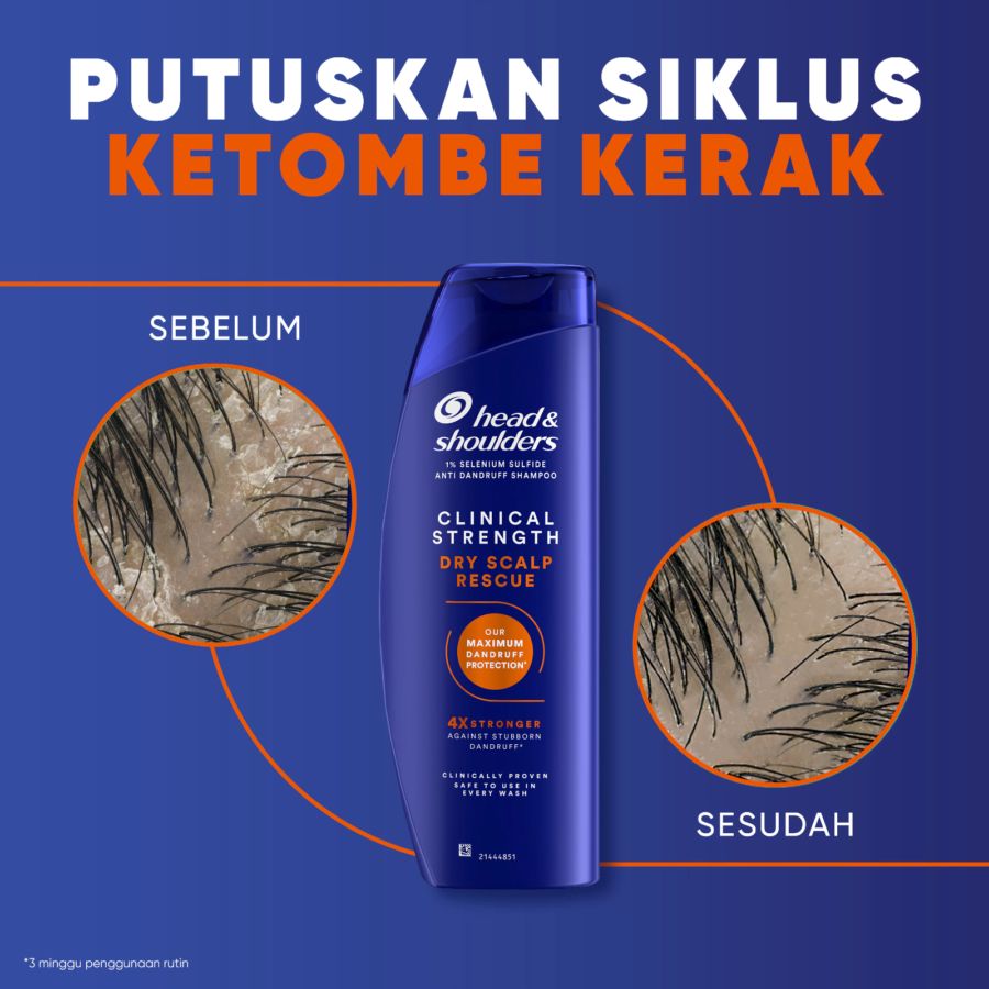 Head & Shoulders Clinical Strength Dry Scalp Rescue Anti Dandruff Shampoo 400ml