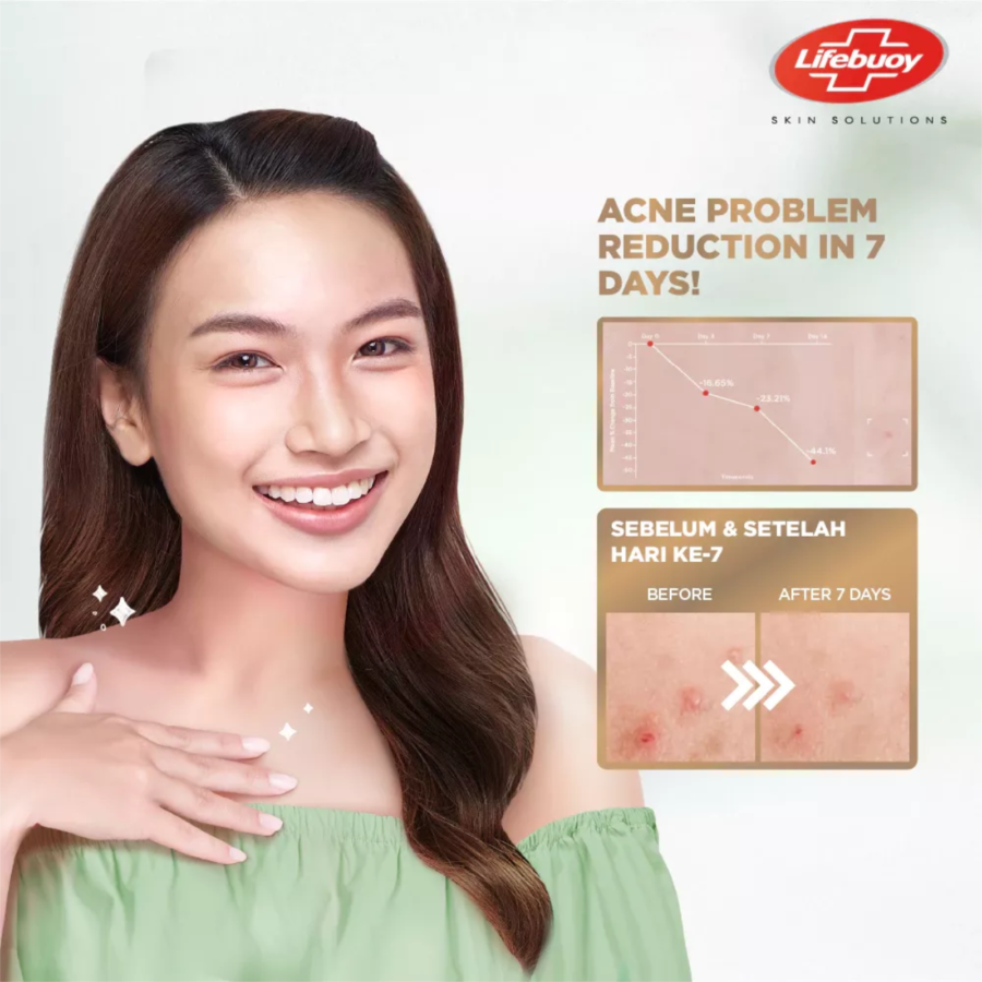 Lifebuoy Anti Acne Greentea & Aloe Vera Antibacterial Body Wash Refill 2pcs 800gram, 2pcs