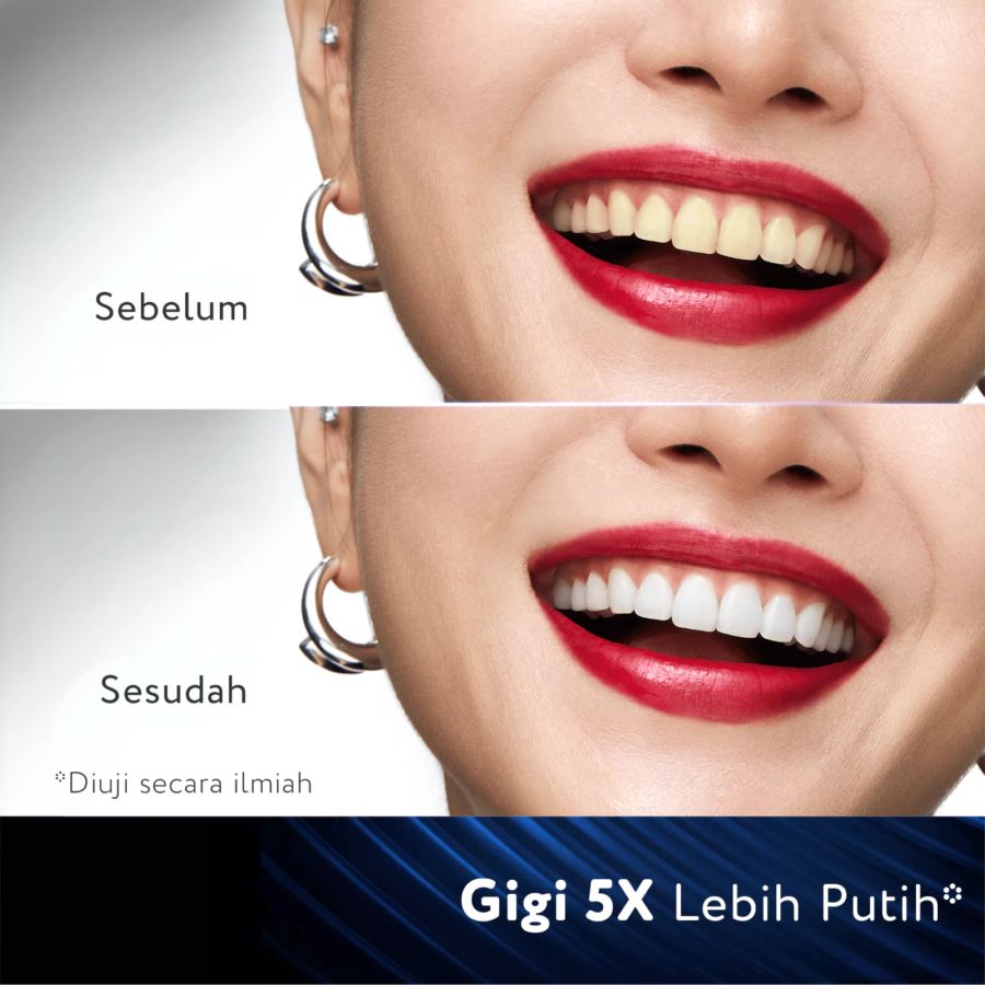 Pepsodent Ultra White Gentle Radiance Pasta Gigi 90gram