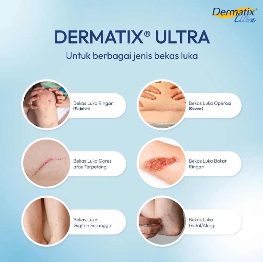 Dermatix Ultra Gel Penghilang Bekas Luka 9gram