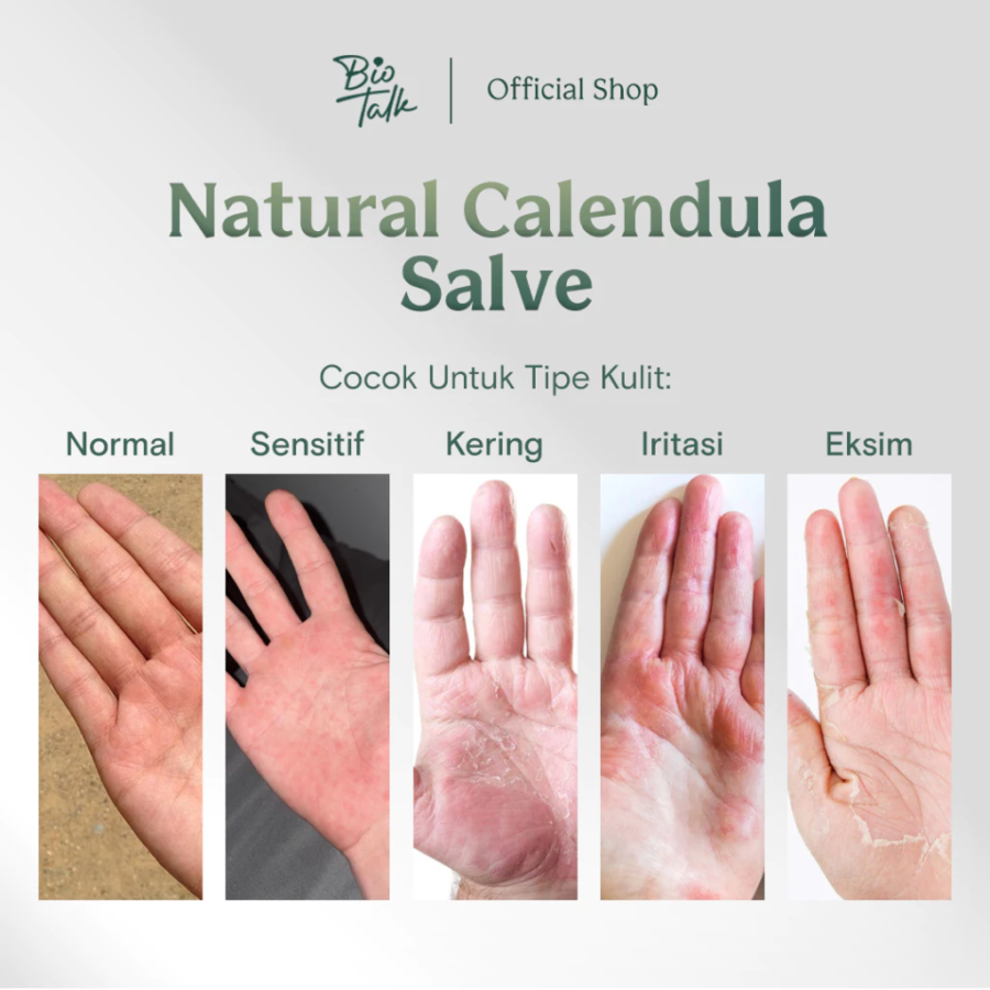 Biotalk Natural Calendula Salve Krim Kulit 30gram