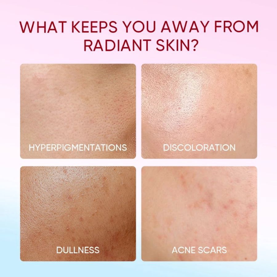 The Originote Brightening Moisturizer