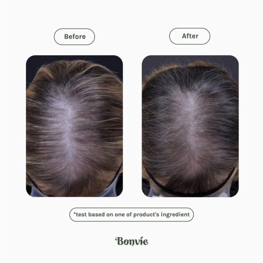 Bonvie Kemiri Gin Hair Tonic Anti Hairfall 60ml
