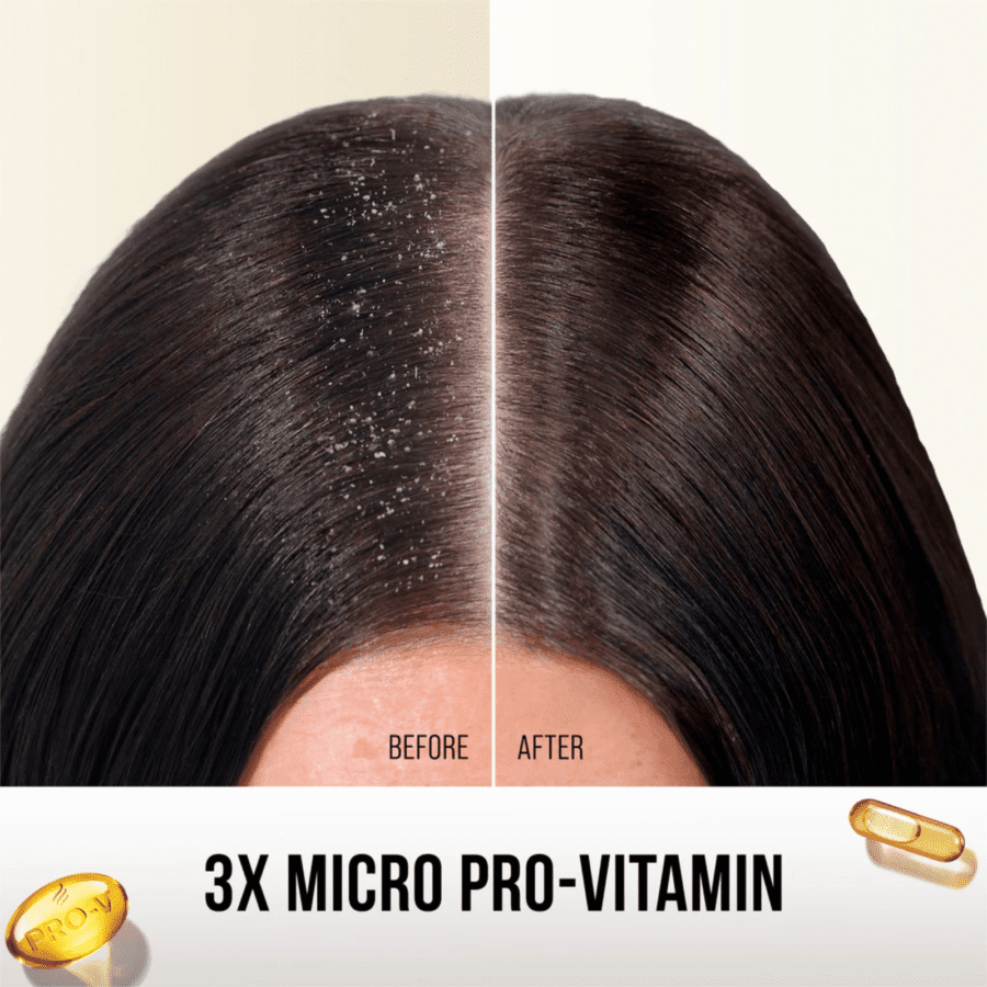 Pantene Pro V 2in1 Anti Ketombe & Perawatan Rambut Rontok Shampoo 900ml
