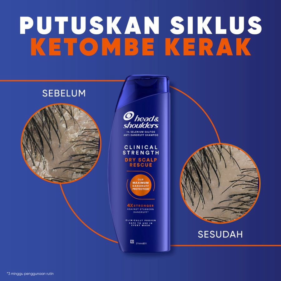 Head & Shoulders Clinical Strength Dry Scalp Rescue Anti Dandruff Shampoo 400ml
