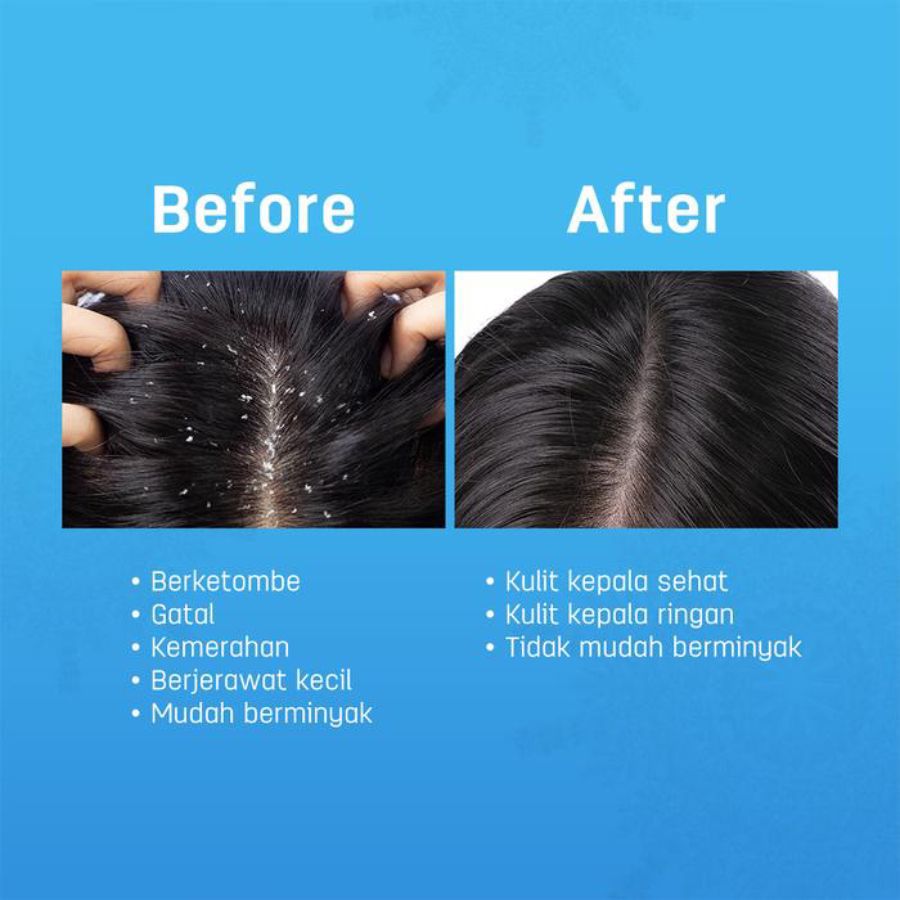 Erhair Scalperfect Allantion & Silk Protein Scalp Soothing Serum Perawatan Rambut 30ml