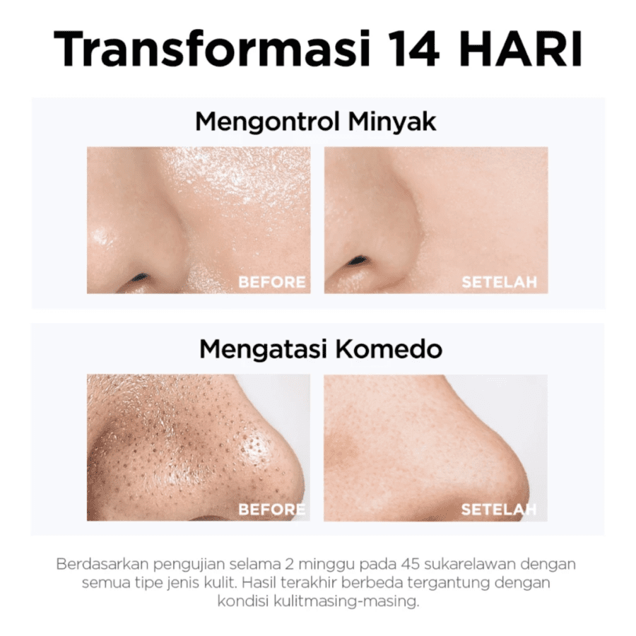Focalskin Bubble Blackhead Remover Facial Cleanser 120gram