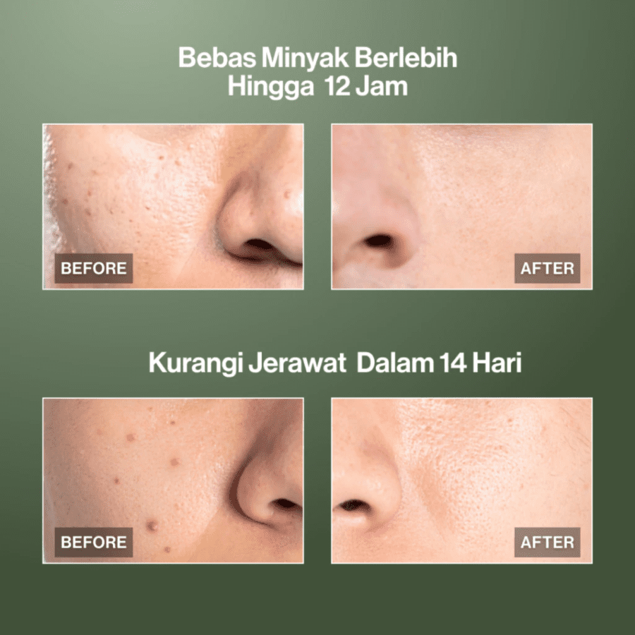 Kahf Oil and Acne Care Face Wash 100ml