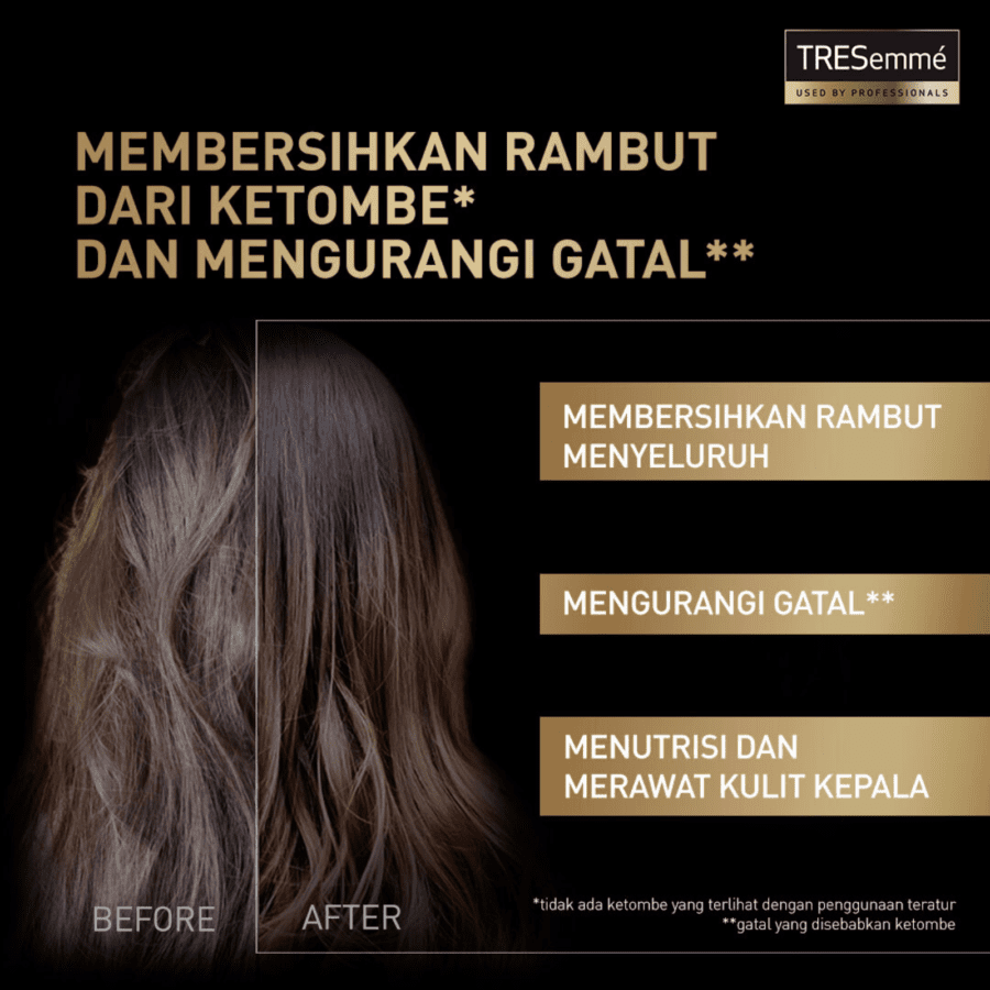 Tresemme Scalp Care Anti Dandruff Shampoo 170ml
