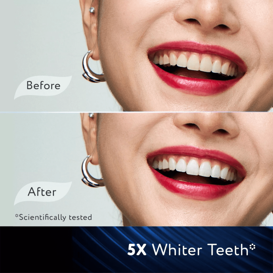 Pepsodent Ultra White Ultimate Bright Pasta Gigi 90gram