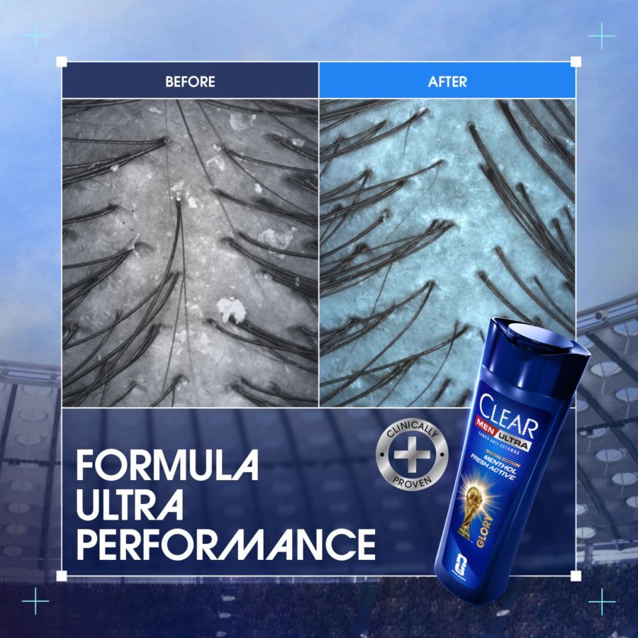 Clear Men Menthol Fresh Active Anti-Dandruff Shampoo FIFA World Cup 2026 TM [Limited Edition] 160ml