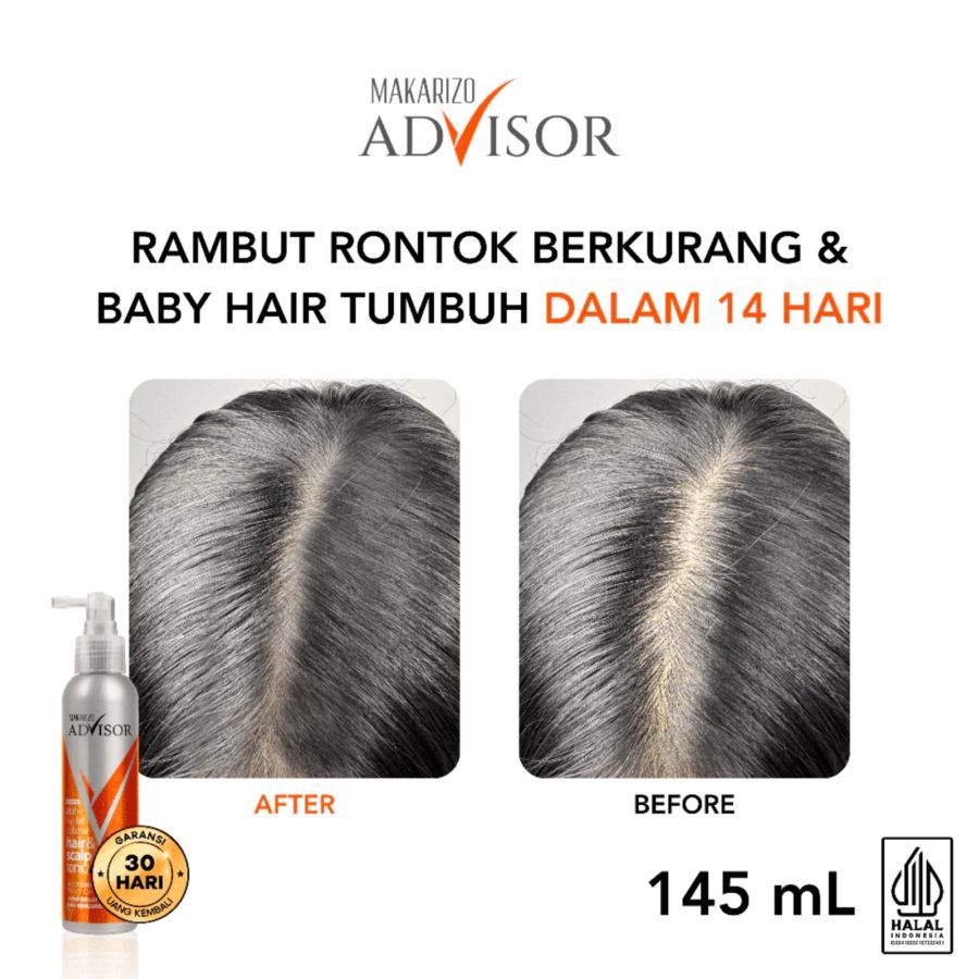 Makarizo Advisor Anti Hairfall Defense Hair & Scalp Tonic 145ml
