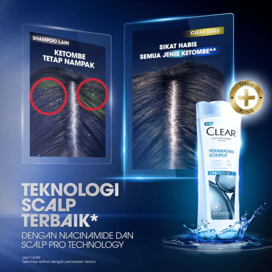 Clear Perawatan Komplit Anti Ketombe Shampoo