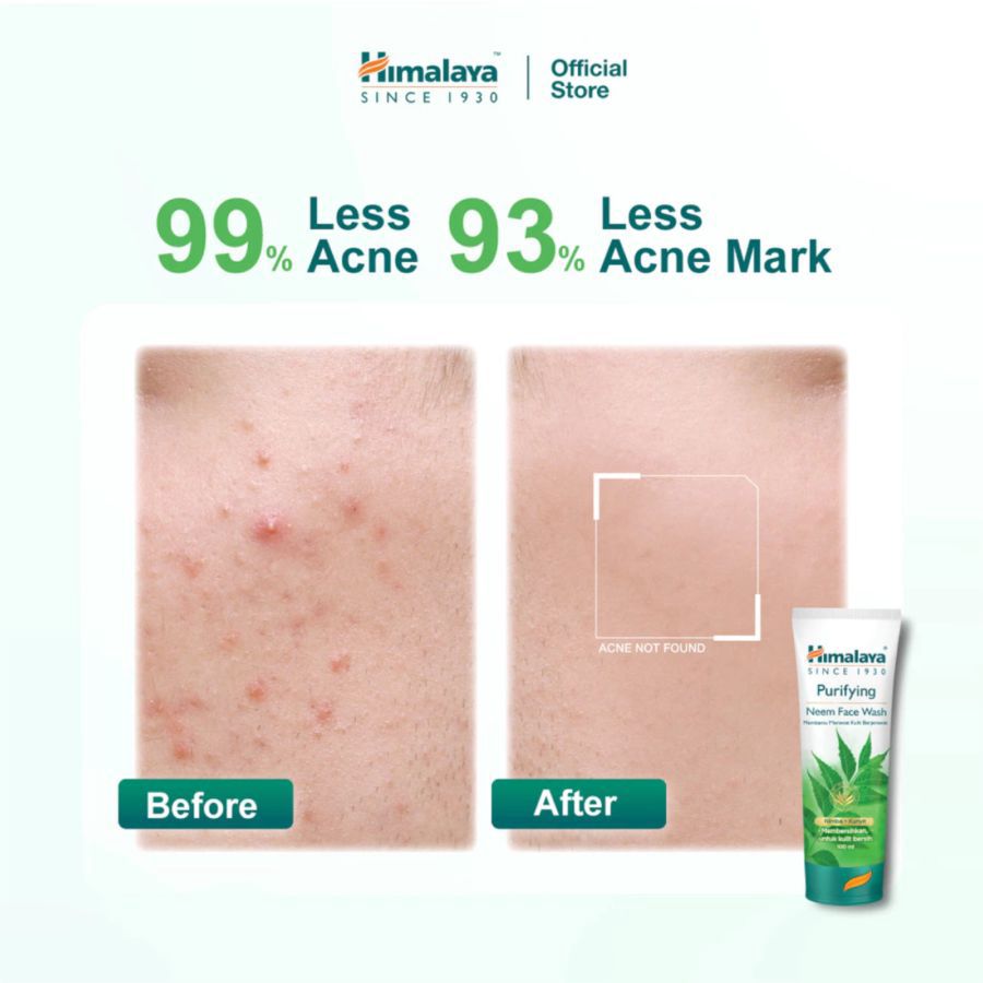 Himalaya Purifying Neem Face Wash 50ml
