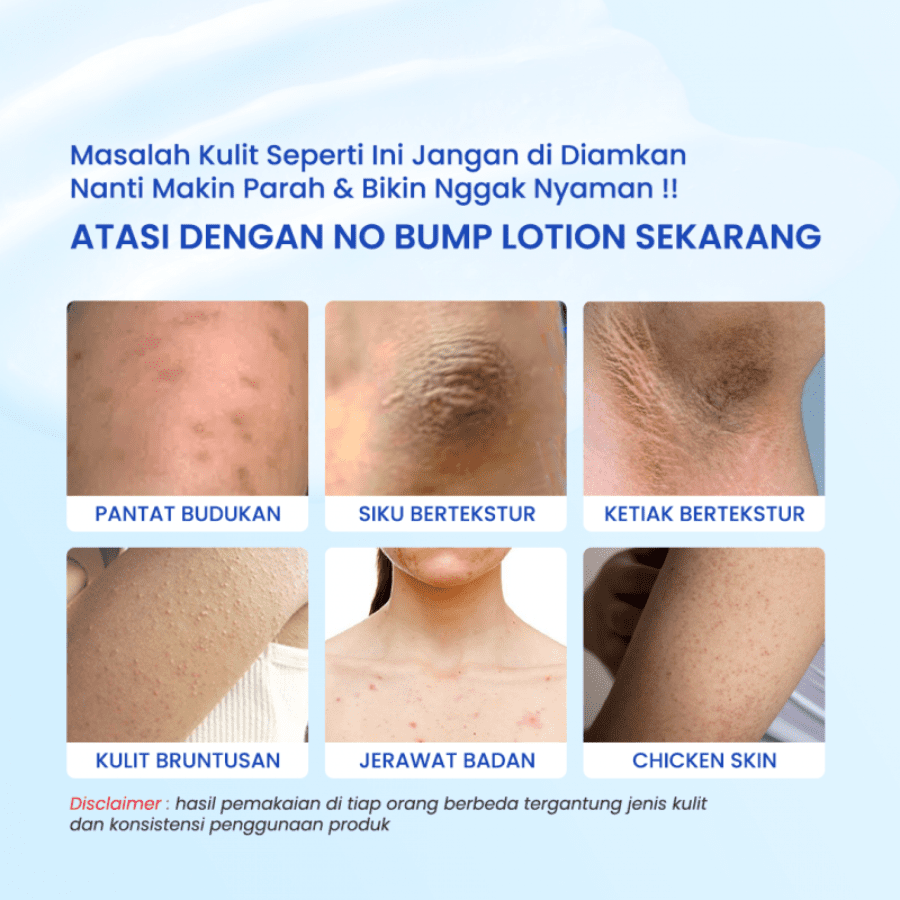 Rintik Skincare No Bump Lotion Gently Exfoliates Body Lotion 100ml