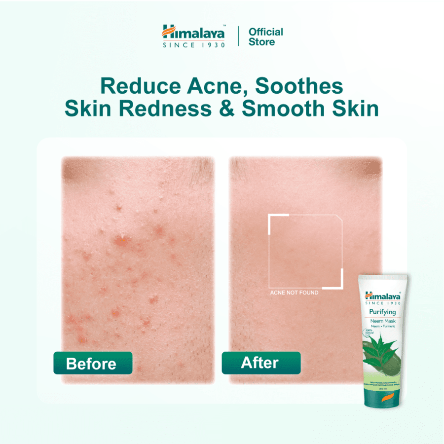 Himalaya Purifying Neem Face Mask 50ml