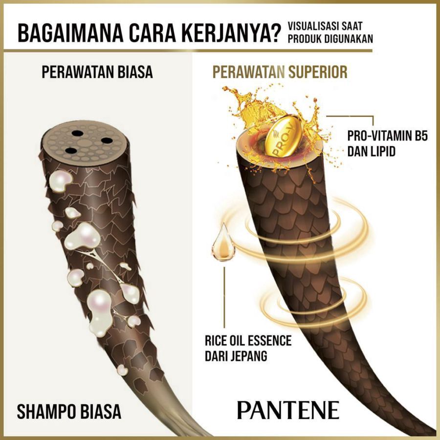Pantene Pro-V 2in1 Anti Ketombe & Perawatan Rontok Shampoo 400ml