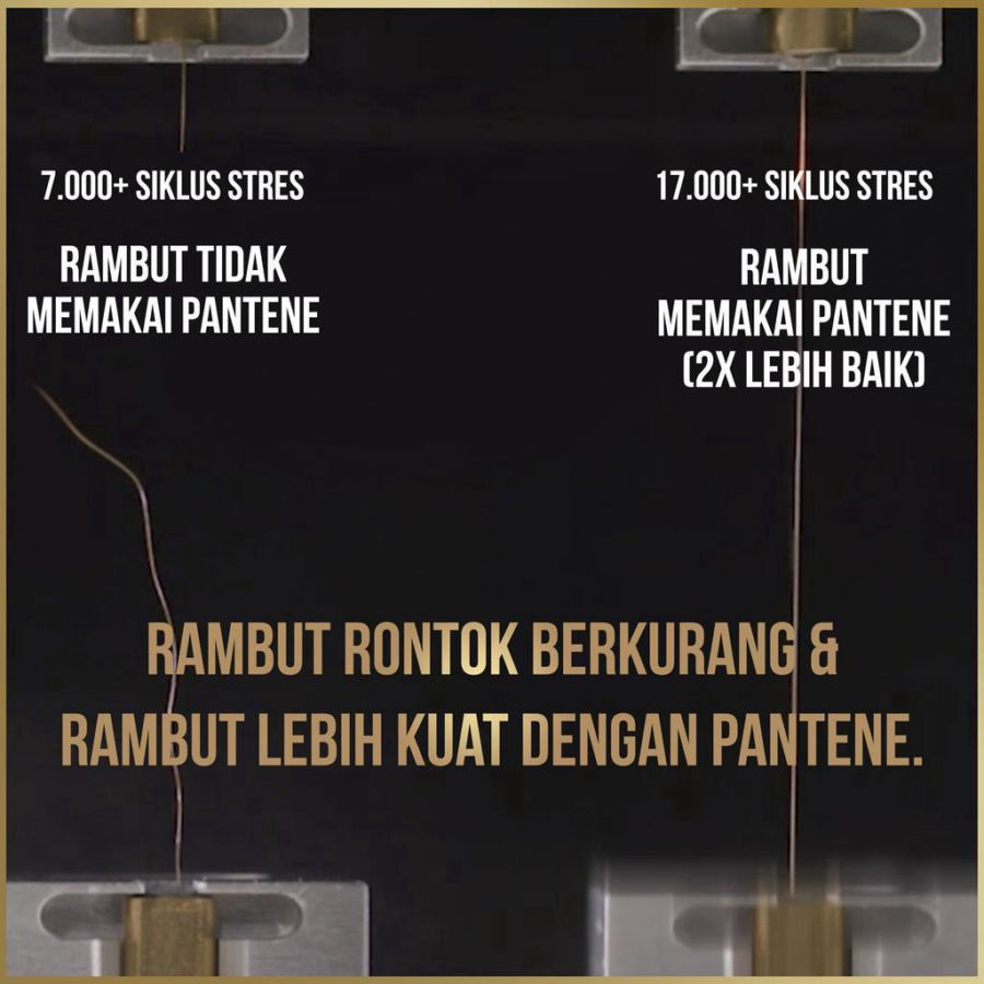 Pantene Pro-V 2in1 Anti Ketombe & Perawatan Rontok Shampoo 400ml