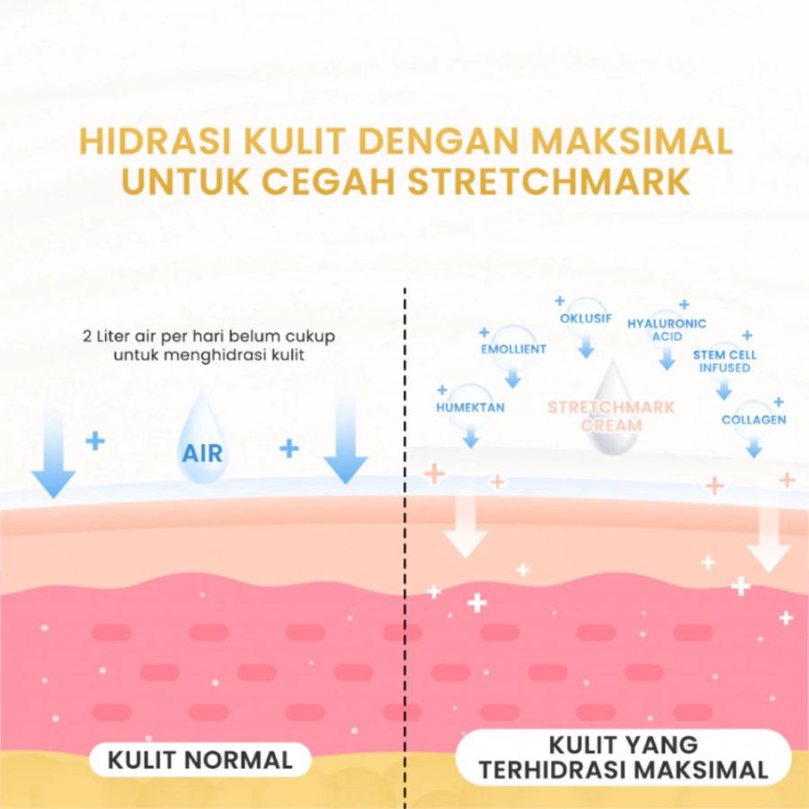 Rintik Skincare Stretchmark Cream 200ml