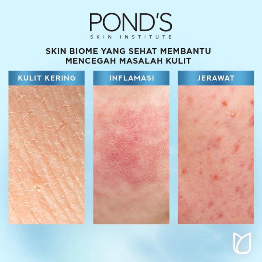 Pond's Hydra Miracle Ultra Light Biome Gel Pelembab Wajah 20gram