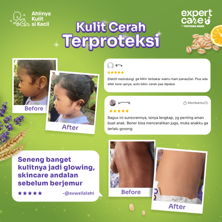 Expert Care Daily Moisturizing Sun prOATection SPF 50+ PA+++ Perawatan Bayi