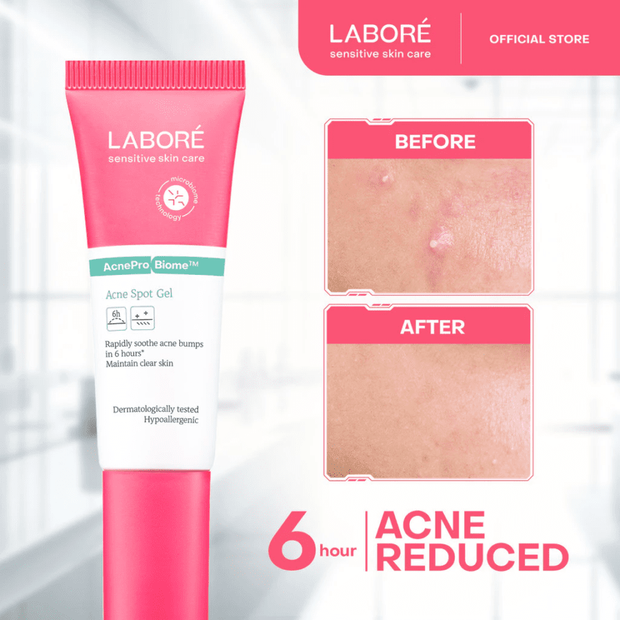 LABORE Sensitive Skin Care Acne Spot Gel 15ml