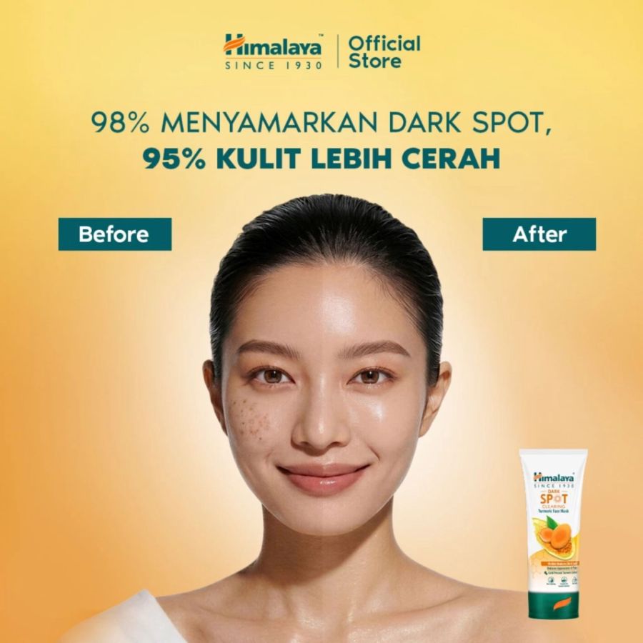 Himalaya Dark Spot Clearing Turmeric Face Mask
