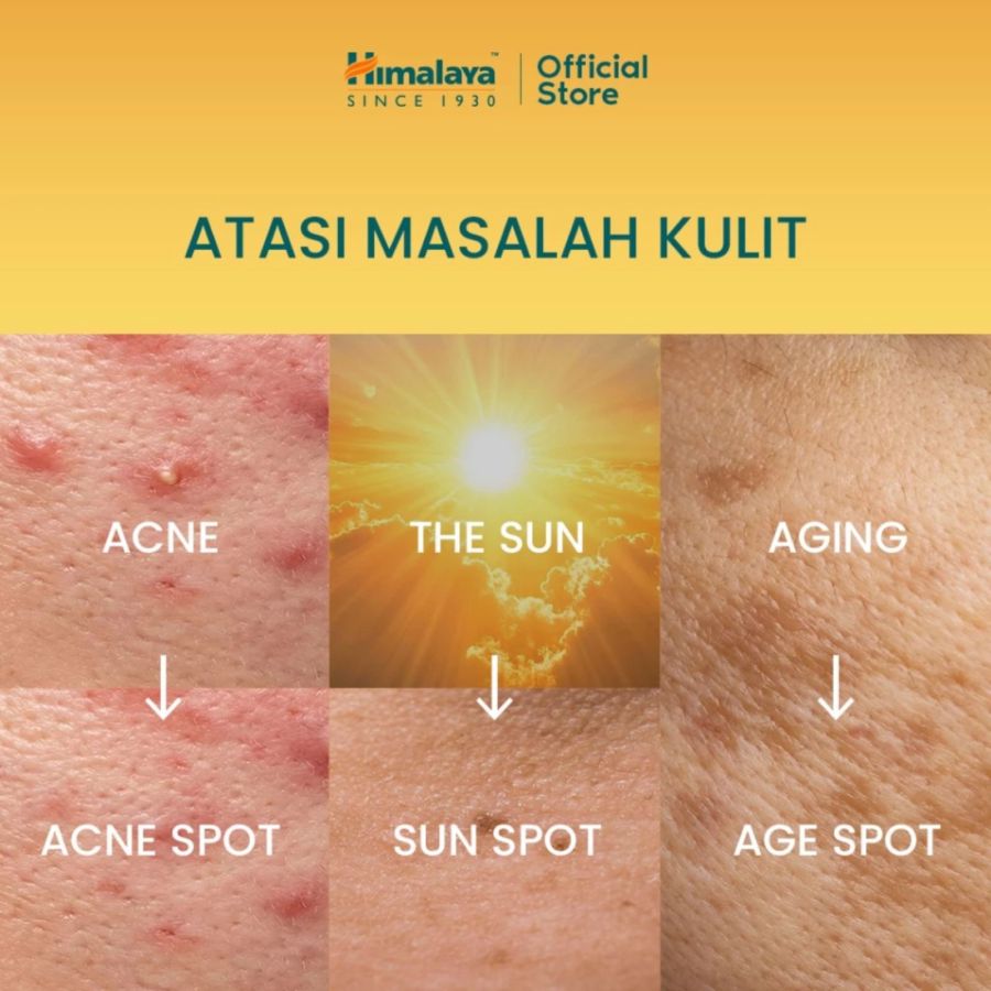 Himalaya Turmeric Dark Spot Face Serum