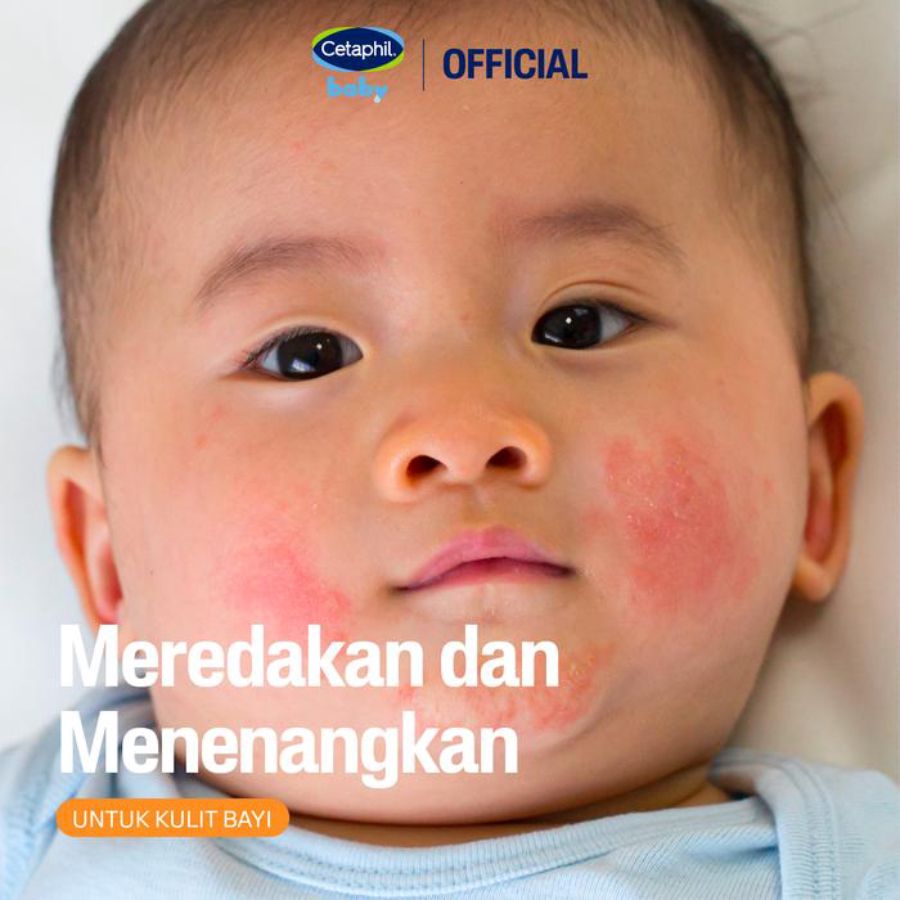 Cetaphil Baby Daily Lotion With Calendula 400ml