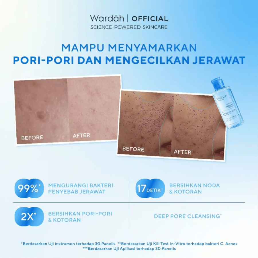 Wardah Acnederm Acne Care Micellar Water