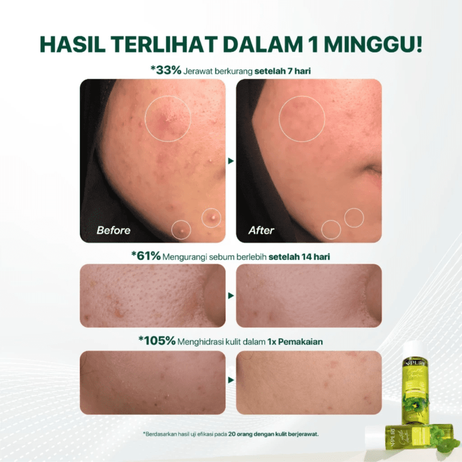 NPURE Centella Asiatica Acne Clear Hydrating & Calming Toner